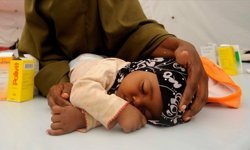 Nijerya'da kızamık salgını..15 çocuk hayatını kaybetti